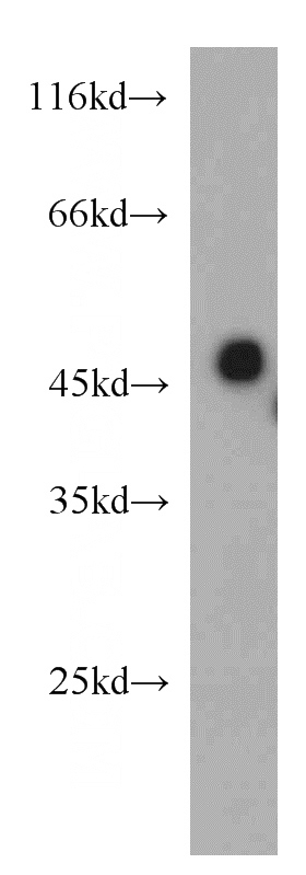 mouse kidney tissue were subjected to SDS PAGE followed by western blot with Catalog No:115372(SLC37A4 antibody) at dilution of 1:500