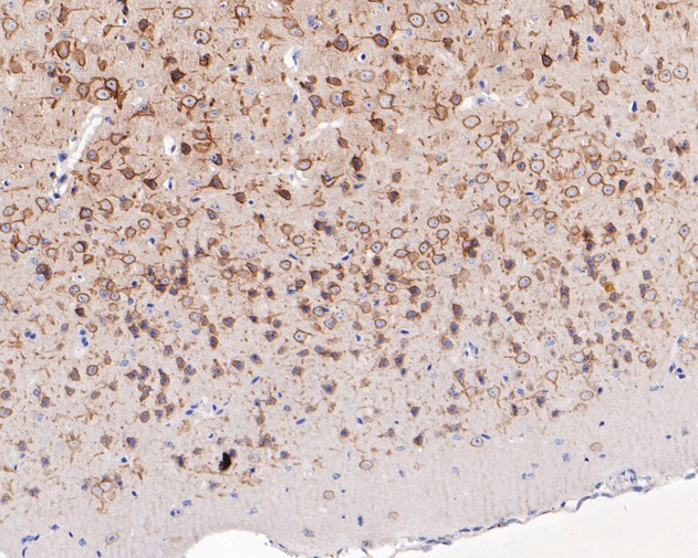 Fig3: Immunohistochemical analysis of paraffin-embedded mouse brain tissue using anti-KCNB1 antibody. The section was pre-treated using heat mediated antigen retrieval with Tris-EDTA buffer (pH 8.0-8.4) for 20 minutes.The tissues were blocked in 5% BSA for 30 minutes at room temperature, washed with ddH2O and PBS, and then probed with the primary antibody ( 1/200) for 30 minutes at room temperature. The detection was performed using an HRP conjugated compact polymer system. DAB was used as the chromogen. Tissues were counterstained with hematoxylin and mounted with DPX.