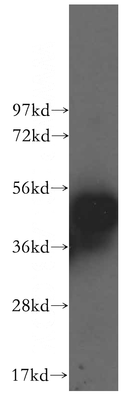 Jurkat cells were subjected to SDS PAGE followed by western blot with Catalog No:114038(POLR1E antibody) at dilution of 1:500