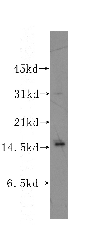 human brain tissue were subjected to SDS PAGE followed by western blot with Catalog No:114334(PTS antibody) at dilution of 1:200