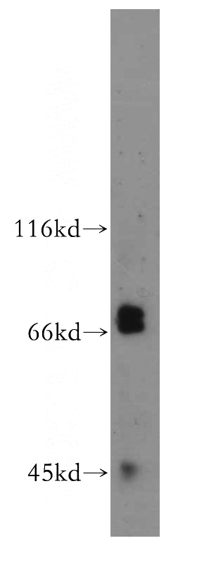 human brain tissue were subjected to SDS PAGE followed by western blot with Catalog No:111773(IL1RAPL1 antibody) at dilution of 1:500