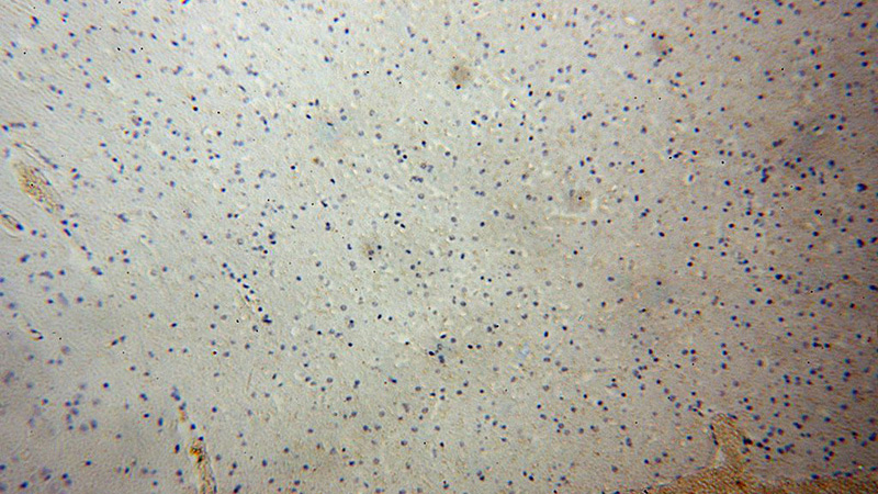 Immunohistochemical of paraffin-embedded human brain using Catalog No:108021(APLP2 antibody) at dilution of 1:50 (under 10x lens)