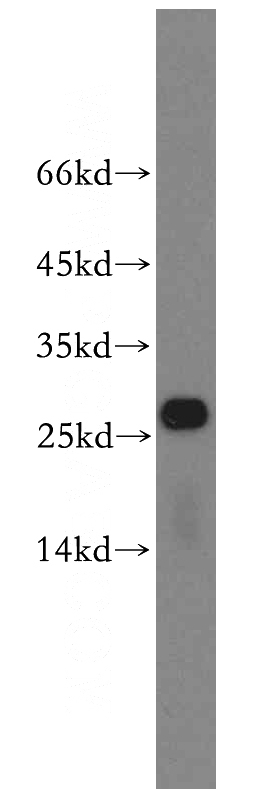 mouse liver tissue were subjected to SDS PAGE followed by western blot with Catalog No:114916(RPS8 antibody) at dilution of 1:600