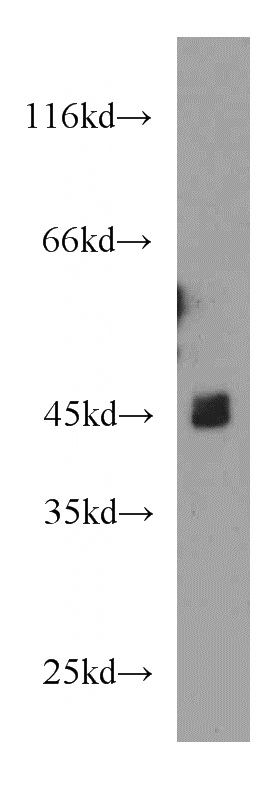 mouse brain tissue were subjected to SDS PAGE followed by western blot with Catalog No:110981(KCNJ6 antibody) at dilution of 1:1000