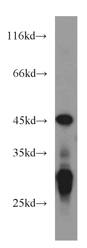 HEK-293 cells were subjected to SDS PAGE followed by western blot with Catalog No:113358(NUDT19 antibody) at dilution of 1:1500
