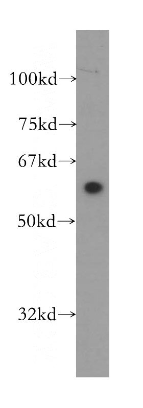 SH-SY5Y cells were subjected to SDS PAGE followed by western blot with Catalog No:116493(TULP3 antibody) at dilution of 1:800