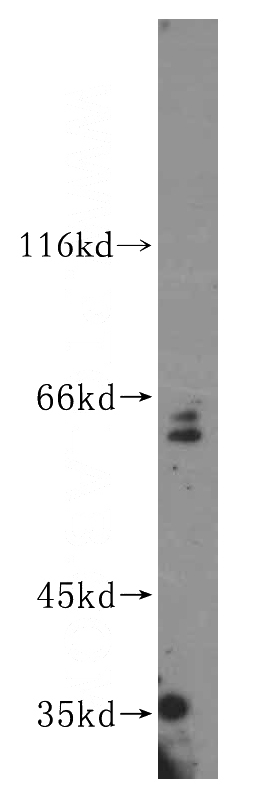 HepG2 cells were subjected to SDS PAGE followed by western blot with Catalog No:113595(PARP6 antibody) at dilution of 1:300