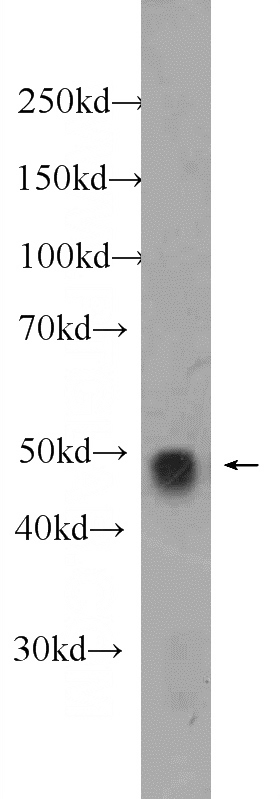MDA-MB-453s cells were subjected to SDS PAGE followed by western blot with Catalog No:115860(WWTR1,TAZ Antibody) at dilution of 1:2000