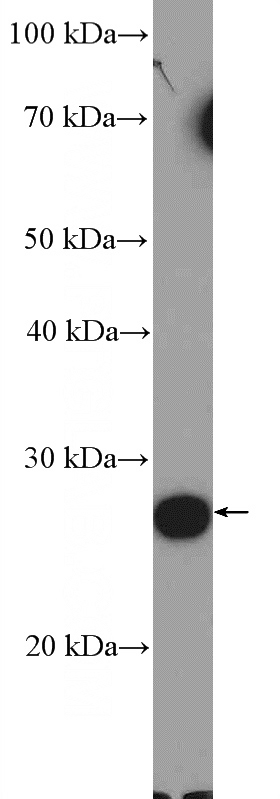 human plasma tissue were subjected to SDS PAGE followed by western blot with Catalog No:108618(C19orf20 Antibody) at dilution of 1:600