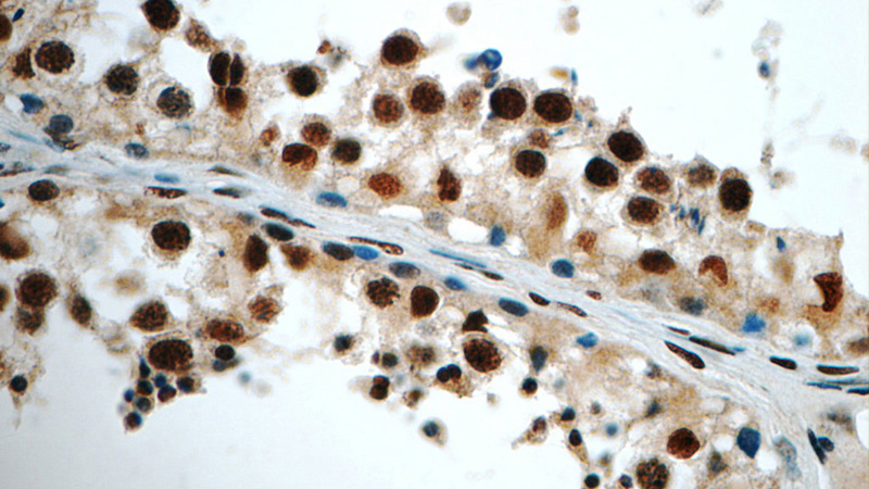 Immunohistochemistry of paraffin-embedded human testis tissue slide using Catalog No:111556(HSF1 Antibody) at dilution of 1:50 (under 40x lens)