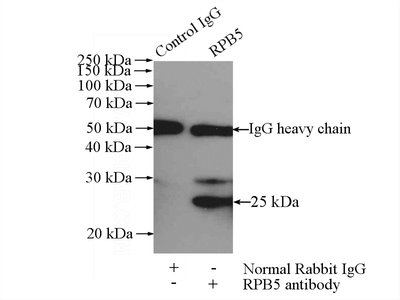 IP Result of anti-RNA Polymerase II (IP:Catalog No:114800, 4ug; Detection:Catalog No:114800 1:500) with HeLa cells lysate 880ug.