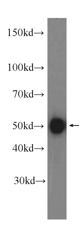 Jurkat cells were subjected to SDS PAGE followed by western blot with Catalog No:111835(IRF3 antibody) at dilution of 1:1000