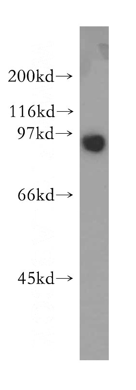 HeLa cells were subjected to SDS PAGE followed by western blot with Catalog No:115092(SECISBP2 antibody) at dilution of 1:400
