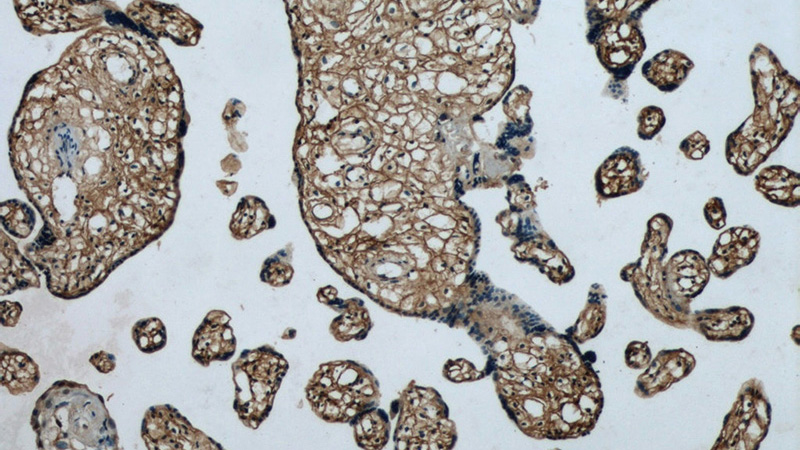 Immunohistochemical of paraffin-embedded human placenta using Catalog No:109179(CEP290 antibody) at dilution of 1:50 (under 10x lens)