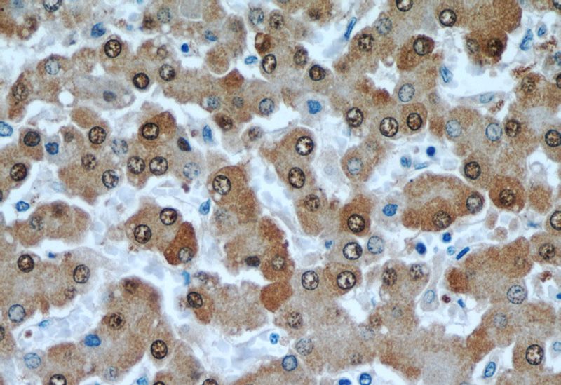 Immunohistochemical of paraffin-embedded human liver using Catalog No:111173(GSNOR,ADH5 antibody) at dilution of 1:50 (under 40x lens)