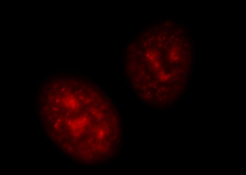 Immunofluorescent analysis of HepG2 cells, using TOP2A antibody Catalog No:116247 at 1:25 dilution and Rhodamine-labeled goat anti-rabbit IgG (red).