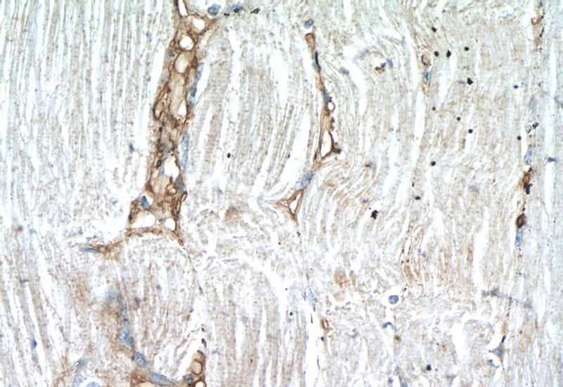 Immunohistochemistry of paraffin-embedded human skeletal muscle tissue slide using Catalog No:110055(DOK7 Antibody) at dilution of 1:50 (under 40x lens)