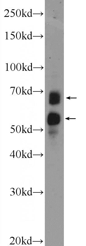 SH-SY5Y cells were subjected to SDS PAGE followed by western blot with Catalog No:113401(NTM Antibody) at dilution of 1:600