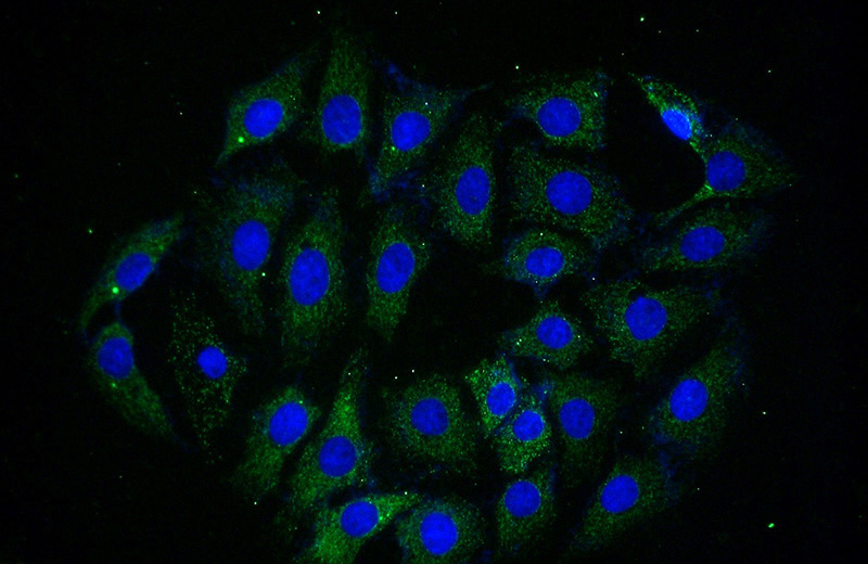 Immunofluorescent analysis of (-20oc Ethanol) fixed SH-SY5Y cells using Catalog No:114649(RGS7 Antibody) at dilution of 1:50 and Alexa Fluor 488-congugated AffiniPure Goat Anti-Rabbit IgG(H+L)