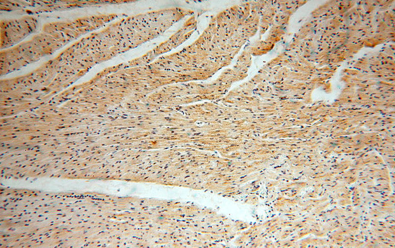 Immunohistochemical of paraffin-embedded human heart using Catalog No:112830(MRPL46 antibody) at dilution of 1:50 (under 10x lens)