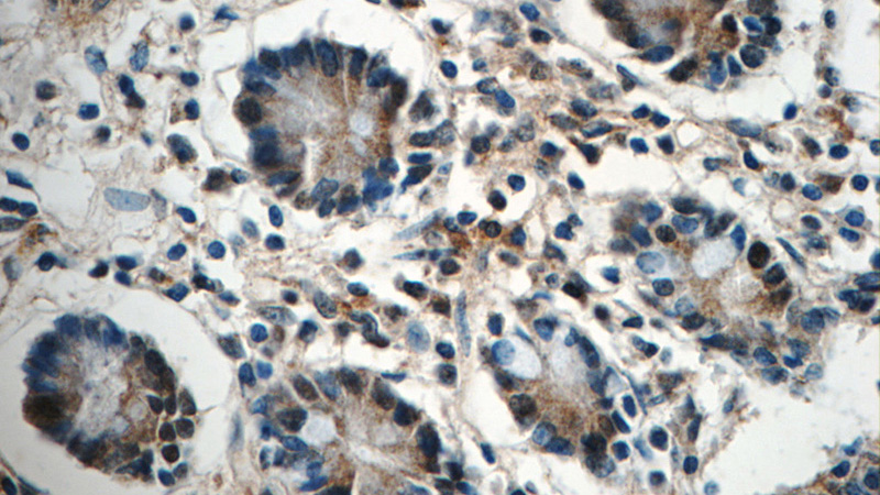Immunohistochemistry of paraffin-embedded human small intestine tissue slide using Catalog No:116923(ZC3H12A Antibody) at dilution of 1:50 (under 40x lens)
