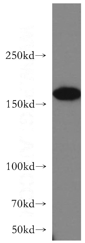 HeLa cells were subjected to SDS PAGE followed by western blot with Catalog No:114780(RocK2-Specific antibody) at dilution of 1:400