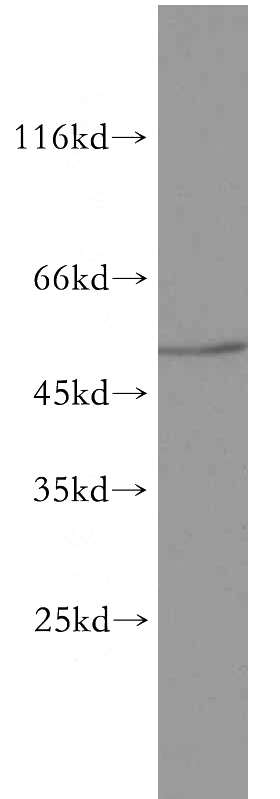 mouse pancreas tissue were subjected to SDS PAGE followed by western blot with Catalog No:115365(SLC30A8-Specific antibody) at dilution of 1:500