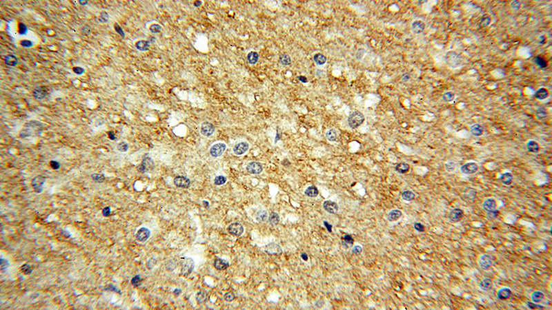 Immunohistochemical of paraffin-embedded human brain using Catalog No:112262(L2HGDH antibody) at dilution of 1:100 (under 40x lens)