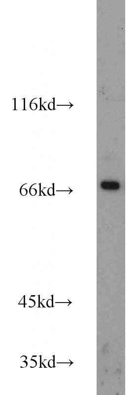 Raji cells were subjected to SDS PAGE followed by western blot with Catalog No:109052(SDC1,CD138 antibody) at dilution of 1:600