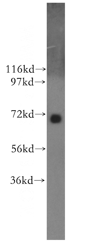 Y79 cells were subjected to SDS PAGE followed by western blot with Catalog No:113402(NUAK2 antibody) at dilution of 1:400