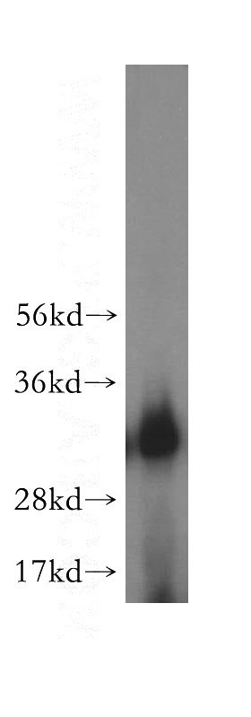 human brain tissue were subjected to SDS PAGE followed by western blot with Catalog No:117071(AUH antibody) at dilution of 1:600