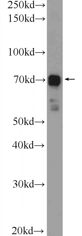 HUVEC cells were subjected to SDS PAGE followed by western blot with Catalog No:109394(CLIP4 Antibody) at dilution of 1:300