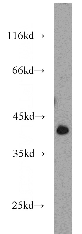 mouse heart tissue were subjected to SDS PAGE followed by western blot with Catalog No:115683(ABRA antibody) at dilution of 1:500
