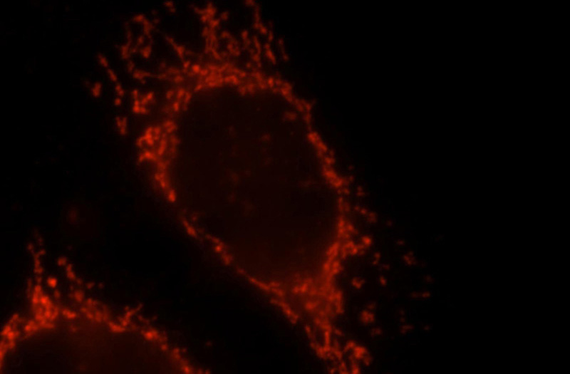 Immunofluorescent analysis of MCF-7 cells, using OXCT1 antibody Catalog No:113524 at 1:25 dilution and Rhodamine-labeled goat anti-rabbit IgG (red).