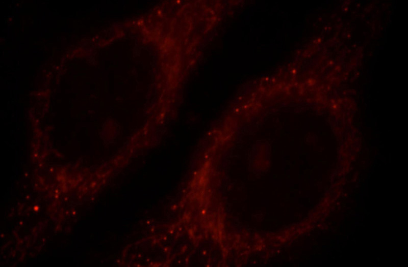 Immunofluorescent analysis of HepG2 cells, using RAB9B antibody Catalog No:114465 at 1:25 dilution and Rhodamine-labeled goat anti-rabbit IgG (red).