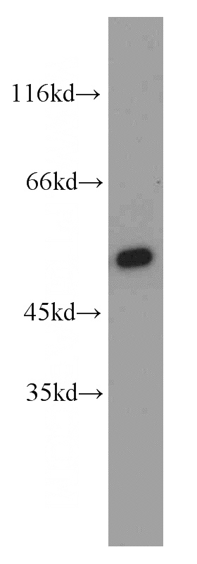 mouse brain tissue were subjected to SDS PAGE followed by western blot with Catalog No:109529(CPSF7 antibody) at dilution of 1:500