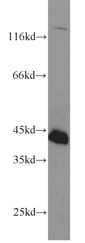 HeLa cells were subjected to SDS PAGE followed by western blot with Catalog No:110527(FAS antibody) at dilution of 1:1000