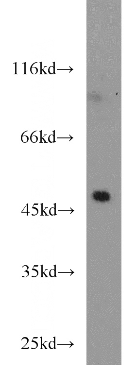 BxPC-3 cells were subjected to SDS PAGE followed by western blot with Catalog No:112129(KRT23 antibody) at dilution of 1:1000