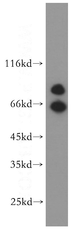 A549 cells were subjected to SDS PAGE followed by western blot with Catalog No:108810(CDH7 antibody) at dilution of 1:400