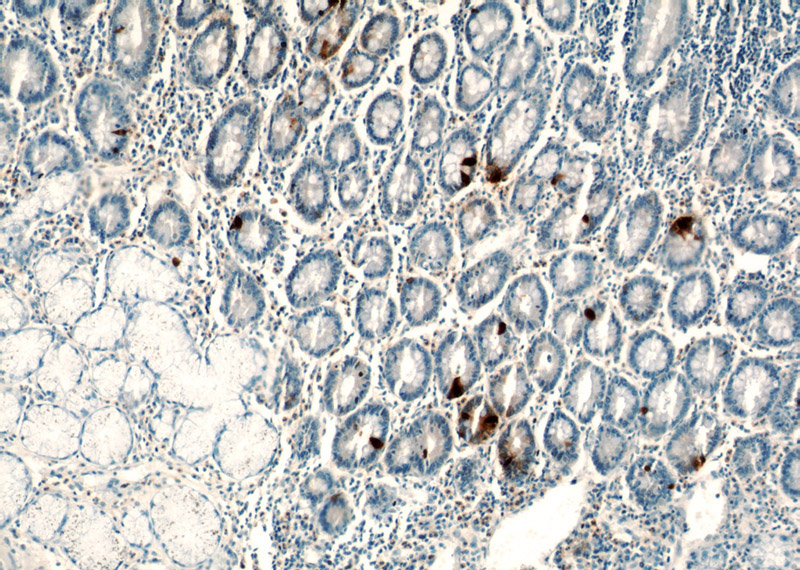 Immunohistochemical of paraffin-embedded human stomach using Catalog No:110875(GAST antibody) at dilution of 1:50 (under 10x lens)