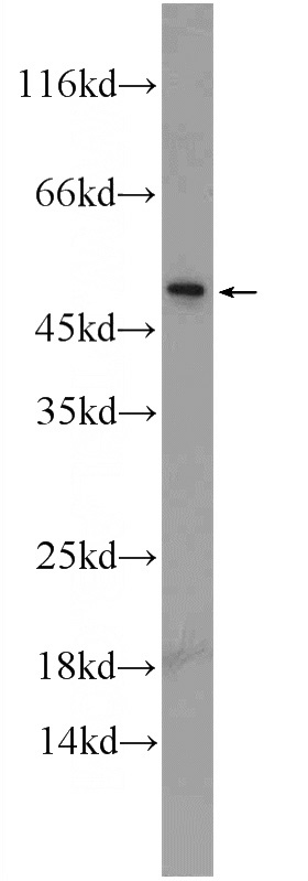 PC-3 cells were subjected to SDS PAGE followed by western blot with Catalog No:108658(C14orf138 Antibody) at dilution of 1:300