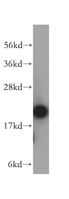 K-562 cells were subjected to SDS PAGE followed by western blot with Catalog No:108166(ARPC3 antibody) at dilution of 1:500