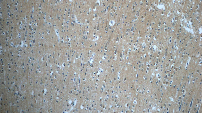 Immunohistochemistry of paraffin-embedded human brain tissue slide using Catalog No:116212(TPPP Antibody) at dilution of 1:50 (under 10x lens)