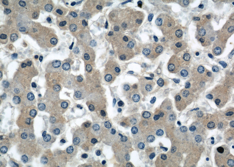 Immunohistochemistry of paraffin-embedded human liver slide using Catalog No:108054(AGT Antibody) at dilution of 1:50