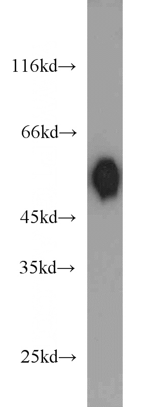 mouse placenta tissue were subjected to SDS PAGE followed by western blot with Catalog No:109994(DLK1 antibody) at dilution of 1:1000
