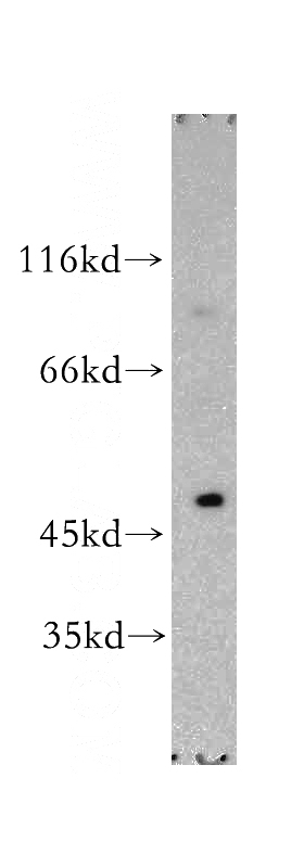 Apoptosised HeLa cells were subjected to SDS PAGE followed by western blot with Catalog No:109756(TRAILR4 antibody) at dilution of 1:300