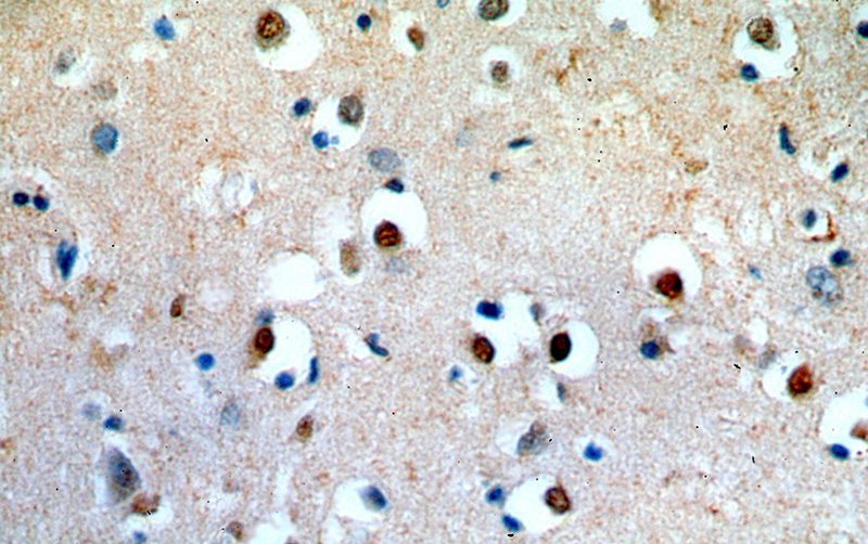 Immunohistochemical of paraffin-embedded human brain using Catalog No:108135(ANAPC4 antibody) at dilution of 1:50 (under 40x lens)