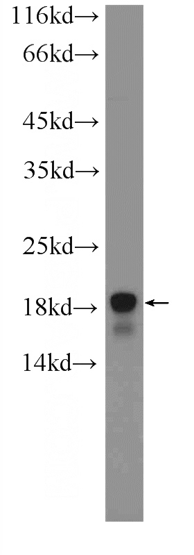 mouse brain tissue were subjected to SDS PAGE followed by western blot with Catalog No:107688(ACP1 antibody) at dilution of 1:1000
