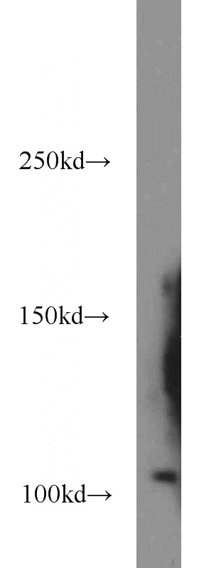 human testis tissue were subjected to SDS PAGE followed by western blot with Catalog No:111818(IPO11 antibody) at dilution of 1:1000