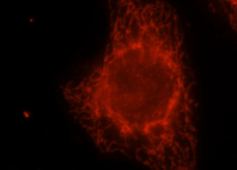 Immunofluorescent analysis of Hela cells, using CISD1 antibody Catalog No:109321 at 1:25 dilution and Rhodamine-labeled goat anti-rabbit IgG (red).